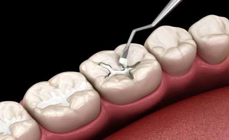 The Role Of General Dentistry In Enhancing Smile Makeover Outcomes
