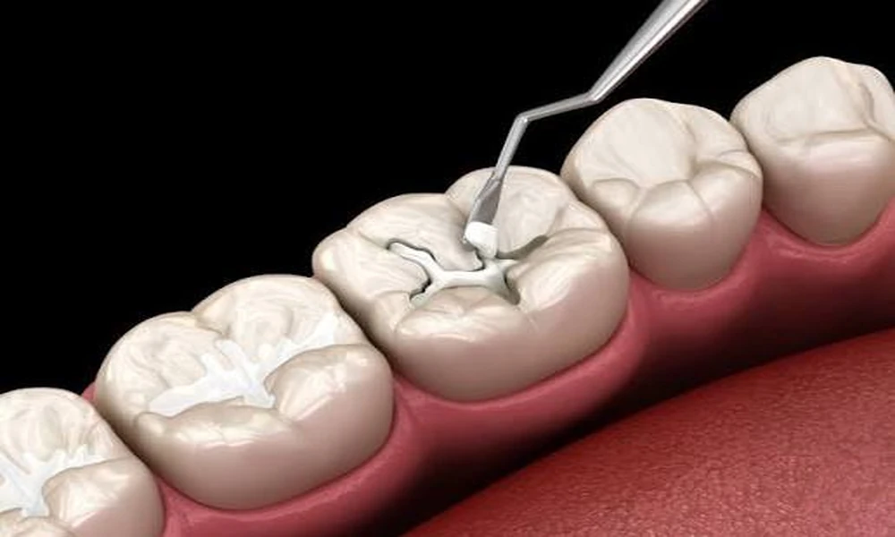 The Role Of General Dentistry In Enhancing Smile Makeover Outcomes